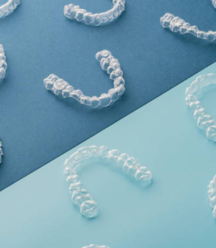 aligner aligner