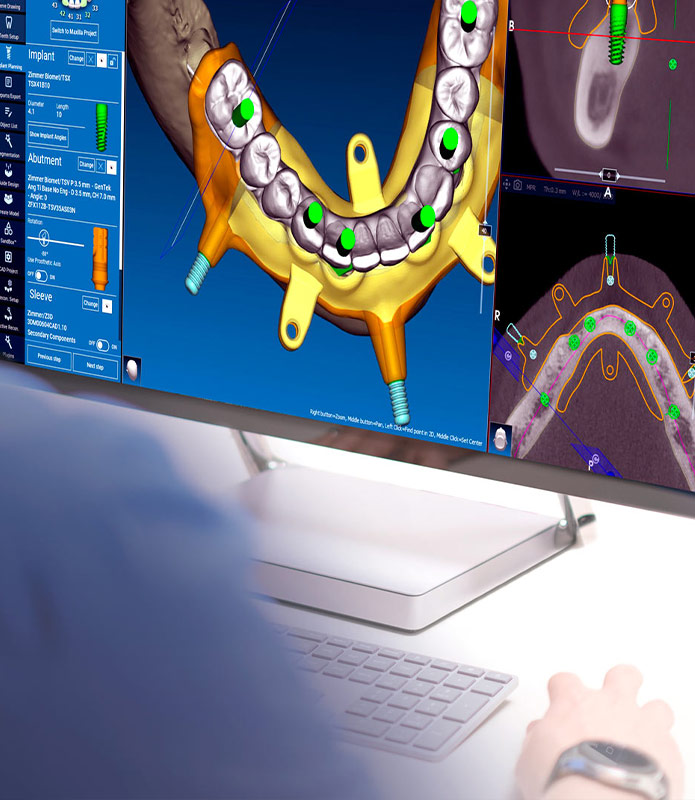 implantology implantology