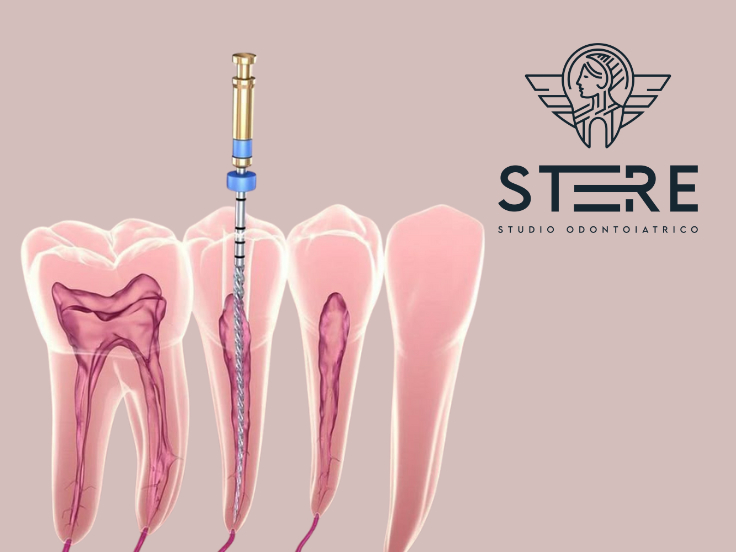 endodontic endodontic