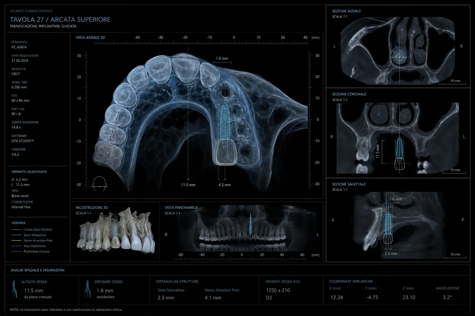 Digital clinical atlas with 3D planning of the dental arch and implant simulation - Studio Odontoiatrico Stere Lecce