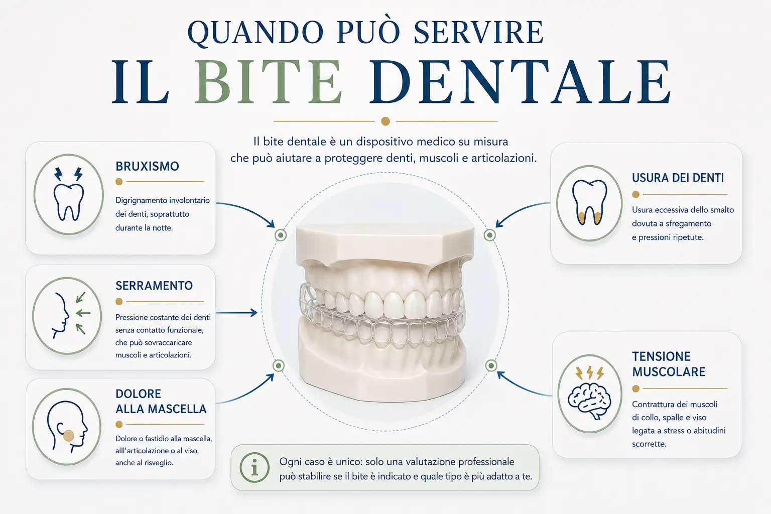 Infografica su quando può servire il bite dentale per bruxismo, serramento, dolore alla mascella, usura dei denti e tensione muscolare