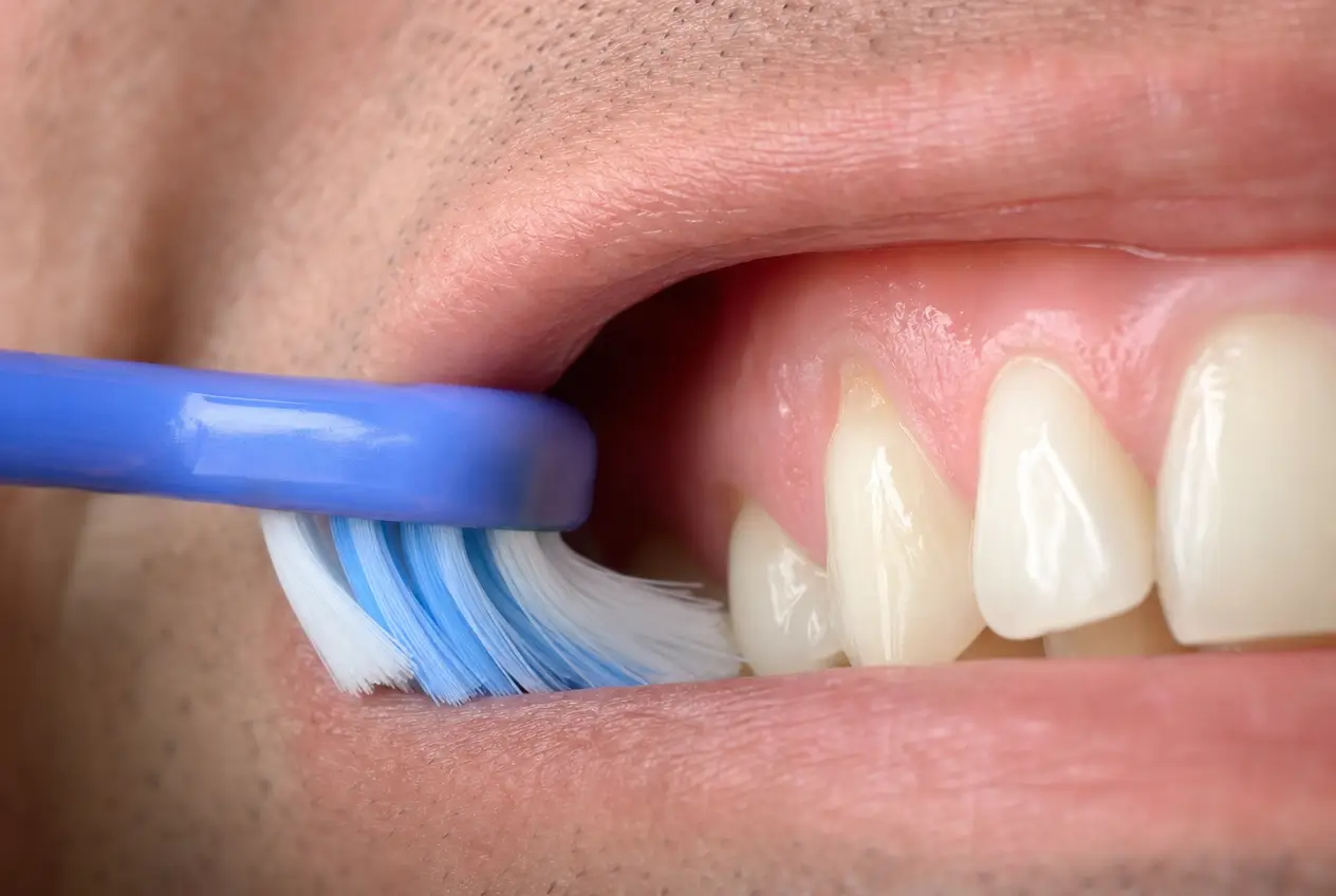 Spazzolino utilizzato con tecnica delicata per prevenire il ritiro delle gengive e proteggere i tessuti gengivali