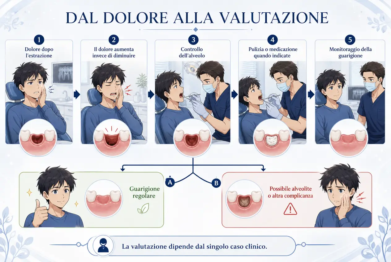 Infografica dello Studio odontoiatrico stere sul percorso dal dolore dopo l’estrazione alla valutazione dell’alveolo, fino al monitoraggio della guarigione o di possibili complicanze.