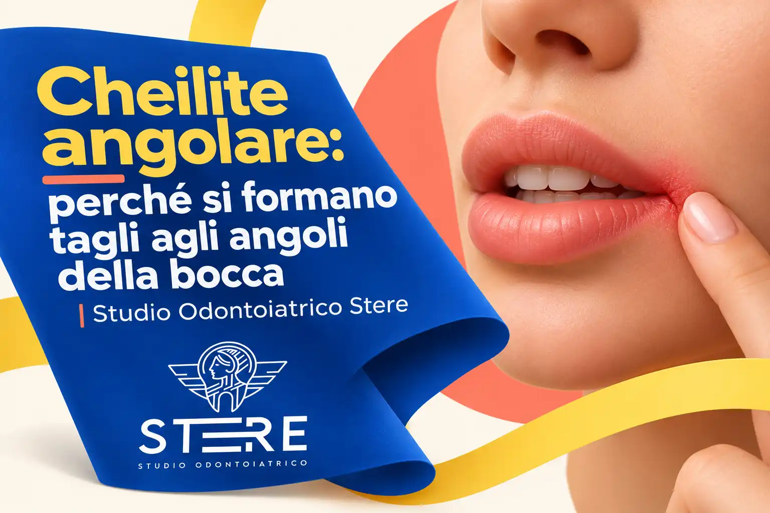 Labbra in ceramica su un piano verde menta e vaso blu con logo Stere, accanto al titolo sulla cheilite angolare.